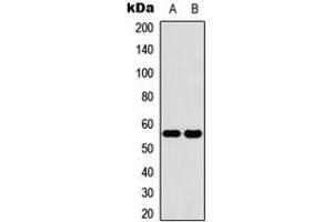 Western Blotting (WB) image for anti-Cytochrome P450, Family 2, Subfamily C, Polypeptide 19 (CYP2C19) (Center) antibody (ABIN7301582)