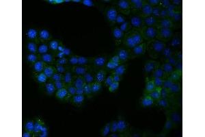 IF analysis of Bcr using anti-Bcr antibody (ABIN4886483). (BCR Antikörper  (AA 1-100))