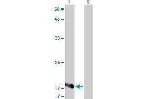 Western Blotting (WB) image for anti-Nudix (Nucleoside Diphosphate Linked Moiety X)-Type Motif 2 (NUDT2) (AA 1-147) antibody (ABIN559885)