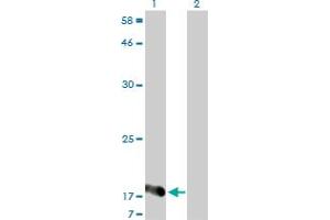 Western Blot analysis of NUDT2 expression in transfected 293T cell line by NUDT2 monoclonal antibody (M01), clone 4A4-3C3.