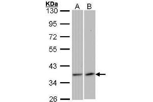 WB Image Sample (30 ug of whole cell lysate) A: 293T B: Raji 10% SDS PAGE antibody diluted at 1:1000 (VEGFD Antikörper)