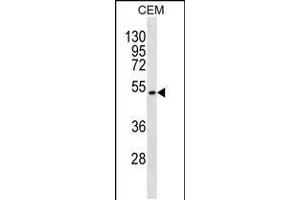 Western blot analysis in CEM cell line lysates (35ug/lane). (TOM1L2 Antikörper  (C-Term))