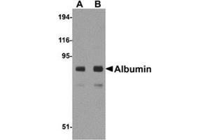 Western blot analysis of Albumin in mouse liver tissue lysate with Albumin antibody at (A) 1 and (B) 2 μg/ml. (Albumin Antikörper  (Center))