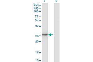 Western Blot analysis of NNMT expression in transfected 293T cell line by NNMT monoclonal antibody (M03), clone 2F2. (NNMT Antikörper  (AA 1-264))