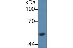 Western Blot; Sample: Rat Liver lysate; Primary Ab: 1µg/ml Rabbit Anti-Rat GCK Antibody Second Ab: 0. (GCK Antikörper  (AA 194-410))