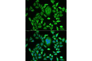 Immunofluorescence analysis of MCF-7 cells using RBP3 antibody (ABIN5973804). (RBP3 Antikörper)