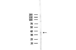 anti-G Protein-Coupled Receptor 160 (GPR160) (C-Term) antibody