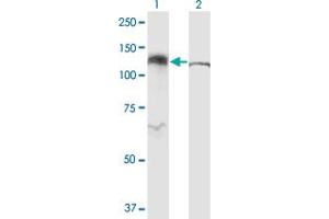 Western Blot analysis of IPO5 expression in transfected 293T cell line by RANBP5 monoclonal antibody (M01), clone 1C4. (Importin 5 Antikörper  (AA 1-100))