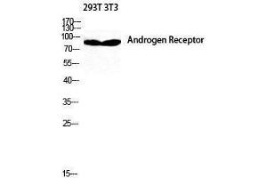 Western Blotting (WB) image for anti-Androgen Receptor (AR) (Ser154) antibody (ABIN3173851) (Androgen Receptor Antikörper  (Ser154))