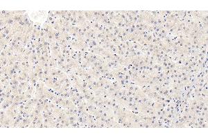 Detection of IGFBP3 in Human Liver Tissue using Monoclonal Antibody to Insulin Like Growth Factor Binding Protein 3 (IGFBP3)