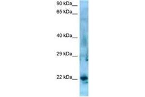 Image no. 1 for anti-Synovial Sarcoma, X Breakpoint 5 (SSX5) (AA 119-168) antibody (ABIN6748426) (SSX5 Antikörper  (AA 119-168))
