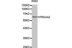 Western Blotting (WB) image for anti-Protein Kinase, AMP-Activated, alpha 2 Catalytic Subunit (PRKAA2) antibody (ABIN1678656) (PRKAA2 Antikörper)