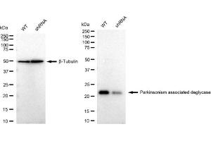 Western blotting analysis using Parkinsonism associated deglycase antibody (ABIN7800048). (Rekombinanter Protein/nucleic Acid Deglycase DJ-1 (PARK7) Antikörper)