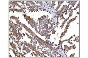 IHC analysis of LRP1B using anti-LRP1B antibody (ABIN7601521). (LRP1B Antikörper  (AA 3704-4547))