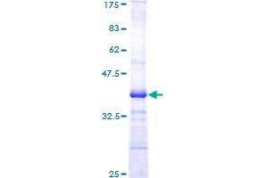 Image no. 1 for V-Akt Murine Thymoma Viral Oncogene Homolog 1 (AKT1) (AA 381-480) protein (GST tag) (ABIN1344780)