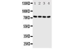 Western Blotting (WB) image for anti-P21-Activated Kinase 6 (PAK6) (AA 16-32), (N-Term) antibody (ABIN3044285) (PAK6 Antikörper  (N-Term))