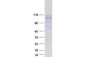 Validation with Western Blot (CEACAM20 Protein (Transcript Variant 5L) (Myc-DYKDDDDK Tag))