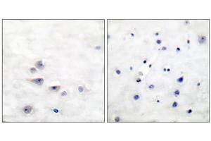 Immunohistochemical analysis of paraffin-embedded human brain tissue using Shc (phospho-Tyr427) antibody. (SHC1 Antikörper  (pTyr427))