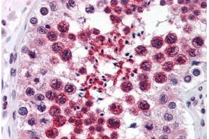 Human Testis (formalin-fixed, paraffin-embedded) stained with RTN4 antibody ABIN343915 at 3 ug/ml followed by biotinylated goat anti-rabbit IgG secondary antibody ABIN481713, alkaline phosphatase-streptavidin and chromogen. (Reticulon 4 Antikörper  (Internal Region))