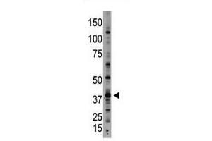 Image no. 1 for anti-Growth Differentiation Factor 1 (GDF1) (N-Term) antibody (ABIN357457) (GDF1 Antikörper  (N-Term))
