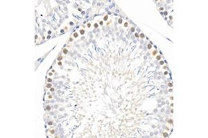 Immunohistochemistry of paraffin-embedded mouse lung using Phospho--S473 Rabbit mAb (ABIN6135179, ABIN6135970, ABIN6135971 and ABIN7101880) at dilution of 1:100 (40x lens). (AKT1 Antikörper  (pSer473))