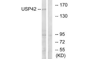 Western blot analysis of extracts from HT-29 cells, using USP42 antibody. (USP42 Antikörper  (Internal Region))