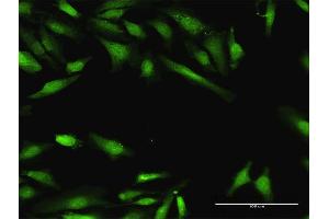 Immunofluorescence of purified MaxPab antibody to BIN1 on HeLa cell. (BIN1 Antikörper  (AA 1-482))