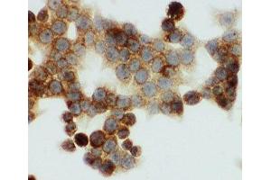 ICC testing of HNF6 antibody and HCT116 cells (ONECUT1 Antikörper  (N-Term))