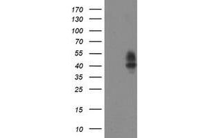 Western Blotting (WB) image for anti-Leucine Rich Repeat Containing 25 (LRRC25) antibody (ABIN1499201) (LRRC25 Antikörper)