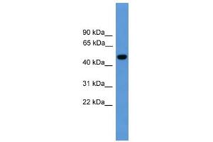 WB Suggested Anti-PSEN1 Antibody Titration: 0. (Presenilin 1 Antikörper  (Middle Region))