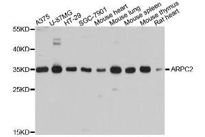 Western blot analysis of extracts of various cell lines, using ARPC2 antibody. (ARPC2 Antikörper  (AA 1-300))