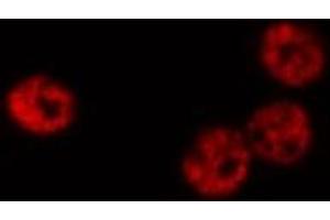 ABIN6268809 staining K-562 cells by IF/ICC. (HNRNPC Antikörper  (C-Term))