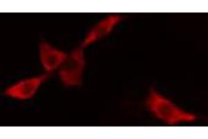 ABIN6268850 staining A549 cells by IF/ICC. (DCT Antikörper  (N-Term))