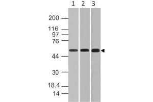 Image no. 1 for anti-RanBP-Type and C3HC4-Type Zinc Finger Containing 1 (RBCK1) (AA 121-333) antibody (ABIN5027252)