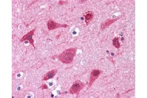 Immunohistochemistry (Paraffin-embedded Sections) (IHC (p)) image for anti-Growth Factor Receptor-Bound Protein 2 (GRB2) (AA 198-217), (C-Term) antibody (ABIN615588)