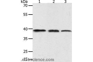 Western blot analysis of PC3 cell, human seminoma and mouse testis tissue, using AMD1 Polyclonal Antibody at dilution of 1:400 (AMD1 Antikörper)