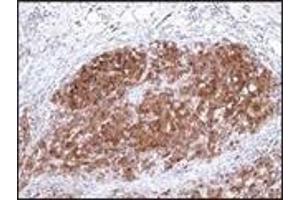 Immunohistochemistry (IHC) image for anti-S-100 (C-Term) antibody (ABIN870449) (S-100 Antikörper  (C-Term))