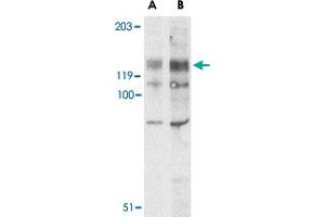 Western blot analysis of BUB1 in A-20 lysate with BUB1 polyclonal antibody  at (A) 2 and (B) 4 ug/mL . (BUB1 Antikörper  (N-Term))