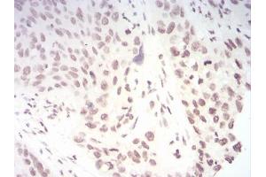 Immunohistochemistry (IHC) image for anti-Telomerase Reverse Transcriptase (TERT) (AA 1029-1132) antibody (ABIN5542472)