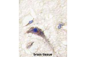 Formalin-fixed and paraffin-embedded human brain tissue reacted with DAAM1 polyclonal antibody  , which was peroxidase-conjugated to the secondary antibody, followed by DAB staining.