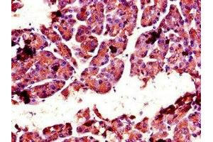 Immunohistochemistry of paraffin-embedded human pancreatic tissue using ABIN7147742 at dilution of 1:100 (Chymotrypsin Antikörper  (AA 90-220))