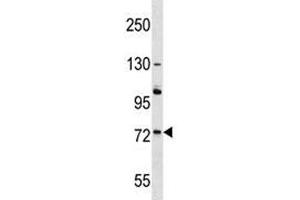 ACOX2 antibody western blot analysis in A375 lysate. (Acox2 Antikörper  (AA 1-30))