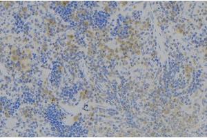 ABIN6277978 at 1/100 staining Human lymph node tissue by IHC-P. (TNFSF4 Antikörper)