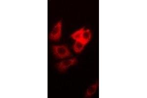 Immunofluorescent analysis of DAP staining in MCF7 cells. (DAP Antikörper)