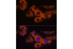 Immunofluorescence analysis of C6 cells using NDRG4 antibody  at dilution of 1:100. (NDRG4 Antikörper  (AA 140-220))