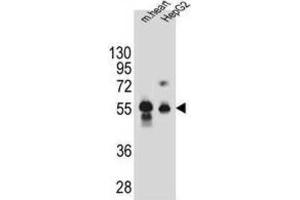 Western Blotting (WB) image for anti-Dipeptidase 3 (DPEP3) antibody (ABIN2995842) (DPEP3 Antikörper)