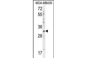 DTWD1 Antibody (Center) (ABIN655477 and ABIN2845000) western blot analysis in MDA-M cell line lysates (35 μg/lane). (DTWD1 Antikörper  (AA 144-173))
