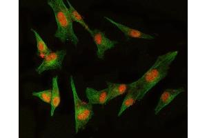 IF analysis of MED8 and Tubulin beta using anti-MED8 antibody (ABIN5519031) and anti-Tubulin beta antibody (ABIN7600339). (MED8 Antikörper  (AA 1-195))
