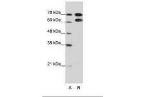 Image no. 2 for anti-Ribonucleoprotein, PTB-Binding 1 (RAVER1) (AA 24-73) antibody (ABIN202804) (RAVER1 Antikörper  (AA 24-73))