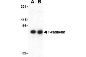 Western Blotting (WB) image for anti-Cadherin 13 (CDH13) (N-Term) antibody (ABIN1031598) (Cadherin 13 Antikörper  (N-Term))